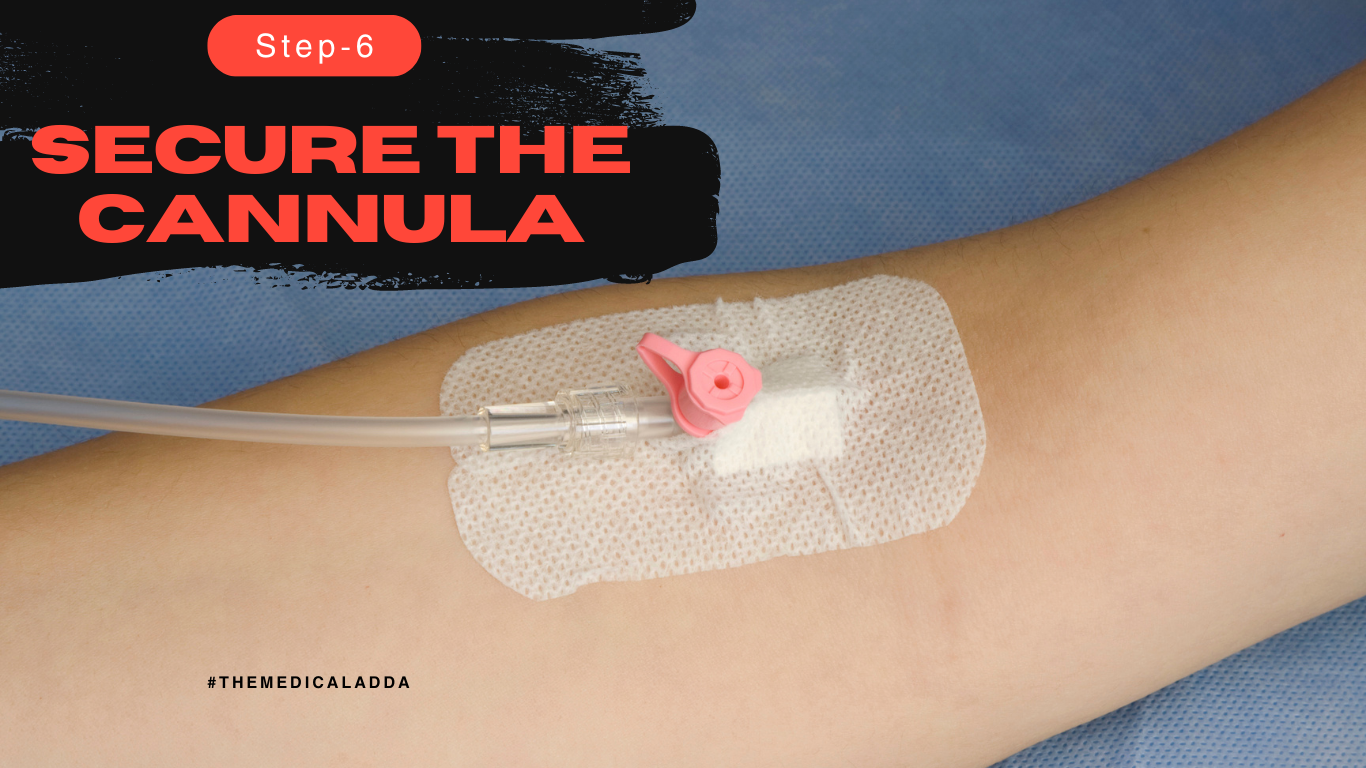 IV Cannulation Technique: 7 Step-by-Step Expert Instructions » The ...